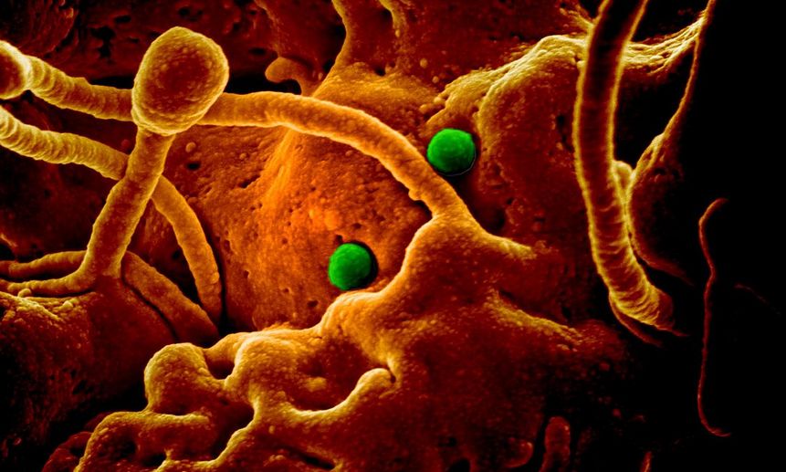 Живые ткани, поражённые коронавирусом ближневосточного респираторного синдрома. Фото NIAID в сотрудничестве с Colorado State University